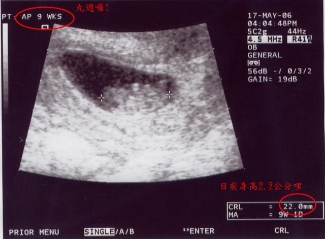 20250406-54kr5